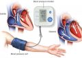 L’hypertension artérielle, une tueuse silencieuse