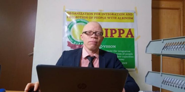 Interview : « les enfants atteints d’albinisme peuvent réussir à l’école si leurs défis sont relevés, » Nicodème Hakizimana