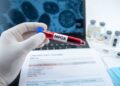 Mpox : Le Nigéria reçoit les premiers vaccins