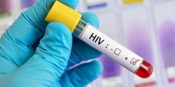 Rwanda-VIH/Sida: des jeunes atteignent la suppression virale….